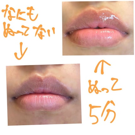 ドトムリッププラスプランパー/keybo/リッププランパーを使ったクチコミ(2枚目)