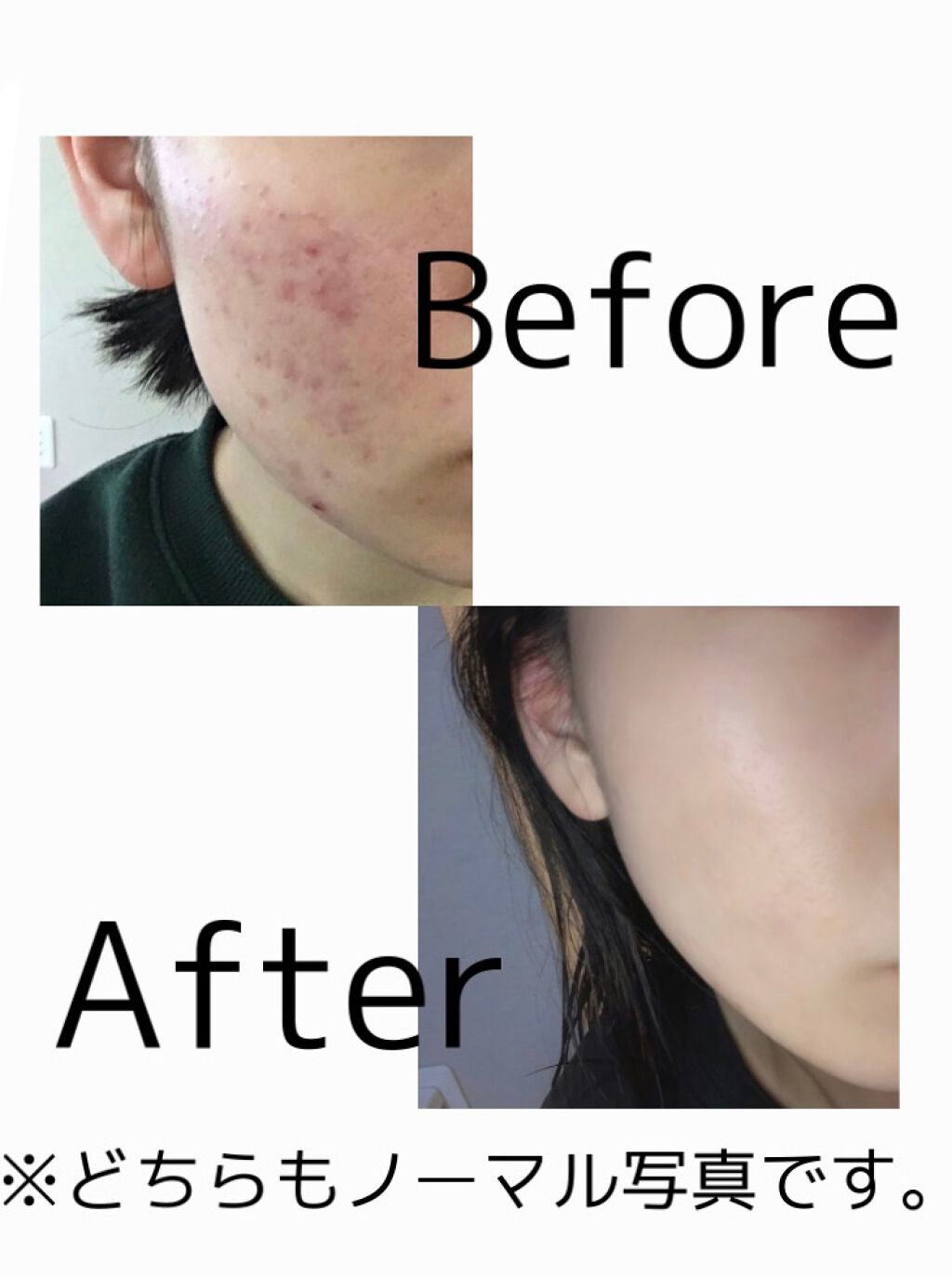 ハトムギ化粧水(ナチュリエ スキンコンディショナー R )/ナチュリエ/化粧水を使ったクチコミ(1枚目)