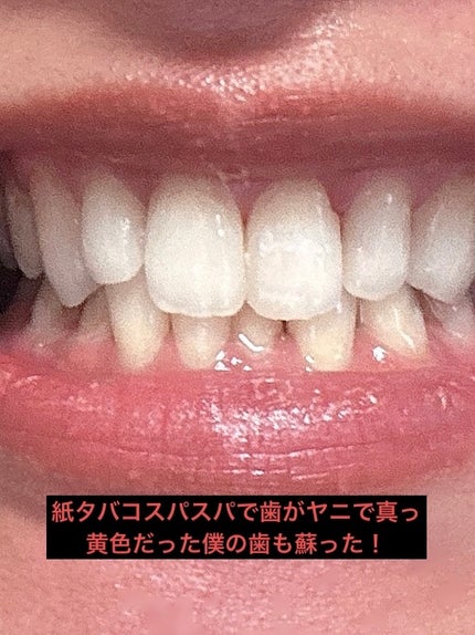 オパールエッセンス ホワイトニングジェル ミント/オパールエッセンス/その他オーラルケアを使ったクチコミ(5枚目)