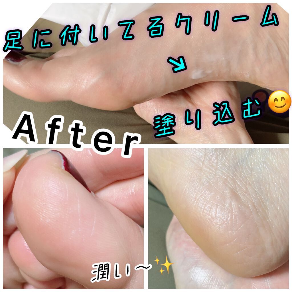 スマイル フット マスク/THE FACE SHOP/レッグ・フットケアを使ったクチコミ(4枚目)