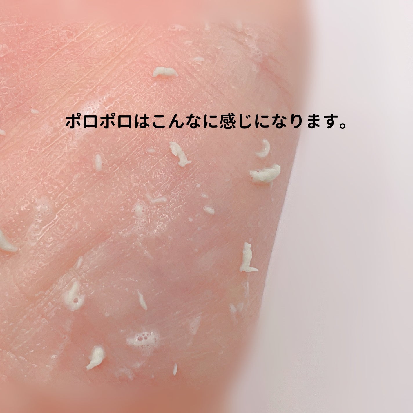 緑豆ミルクピーリングジェル/beplain/ピーリングを使ったクチコミ(5枚目)