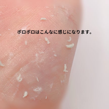 緑豆ミルクピーリングジェル/beplain/ピーリングを使ったクチコミ(5枚目)