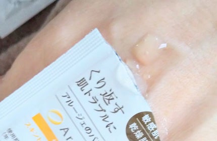 トラブルリペア リキッド/アルージェ/美容液を使ったクチコミ(1枚目)