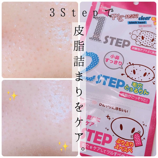 ピッグクリアブラックヘッド3ステップキット(鼻パック)/HOLIKA HOLIKA/シートマスク・パック by 毎日フェイスマスクするひと|100均コスメ&スキンケア