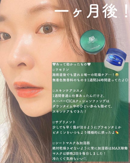 オリジナル ピュアスキンジェリー/ヴァセリン/ボディクリームを使ったクチコミ(4枚目)