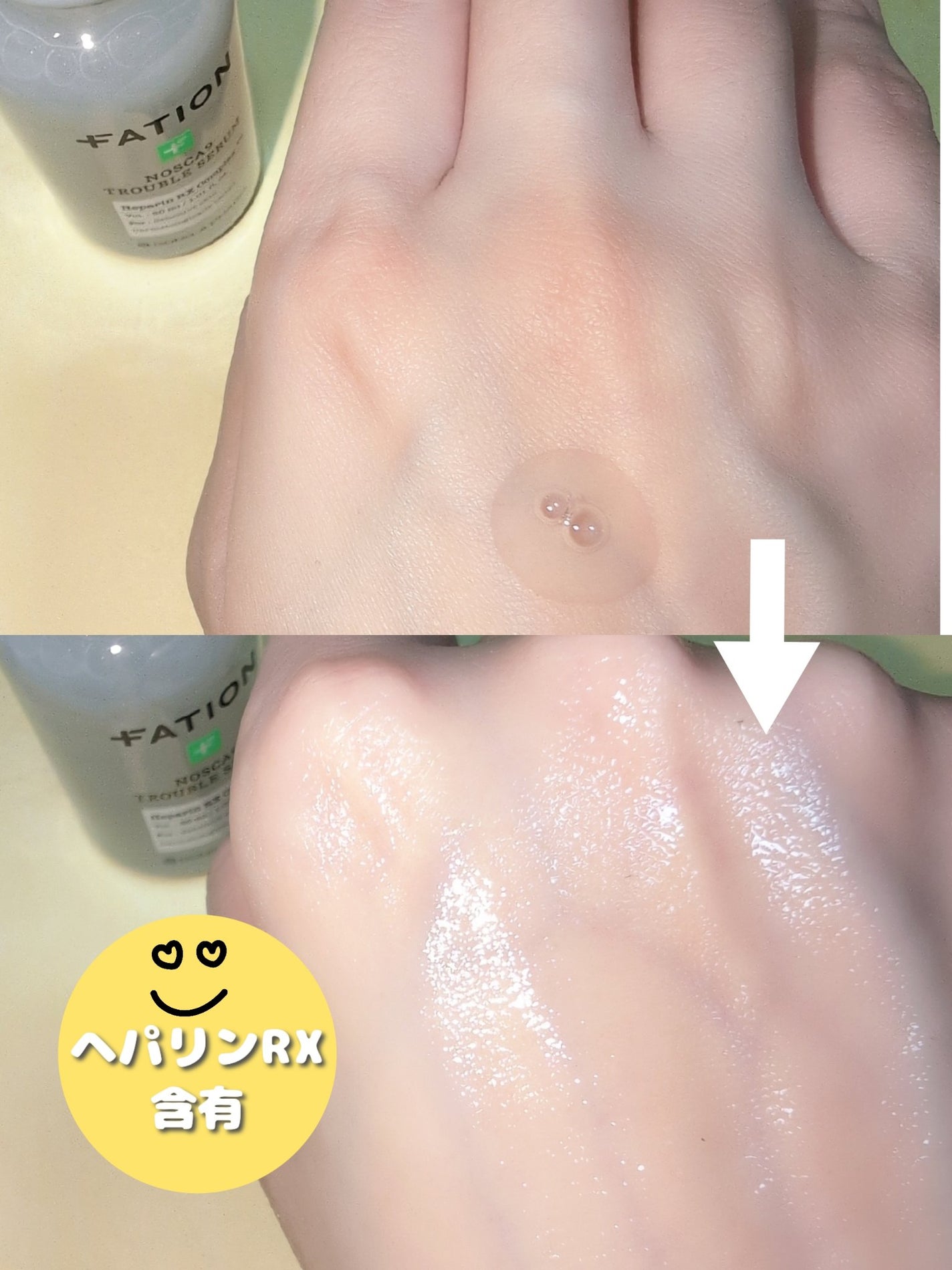 ノスカナイン トラブル セラム/FATION/美容液を使ったクチコミ(4枚目)