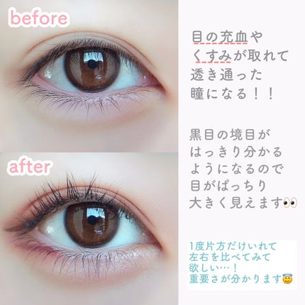 ロートリセ(医薬品)/ロート製薬/その他を使ったクチコミ(3枚目)