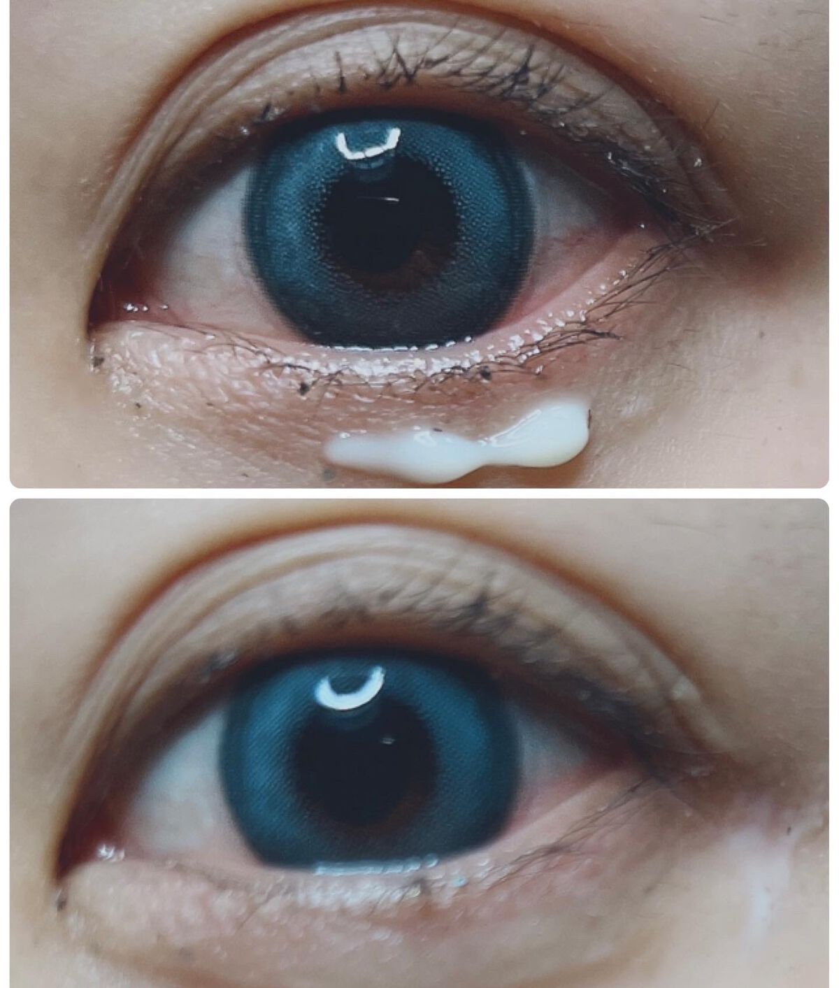 レチノールインテンスリアクティベーションセラム/SOME BY MI/美容液を使ったクチコミ（3枚目）