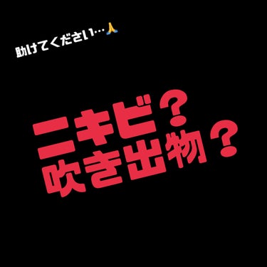 ニキビや吹き出物に効果のある化粧品や、
食生活ルールなど教えていただきたいです🥺

学生の頃からニキビはできにくく対処法が分からず、困っています😭

ニキビなのか吹き出物なのか分かりませんが、
おでこ、