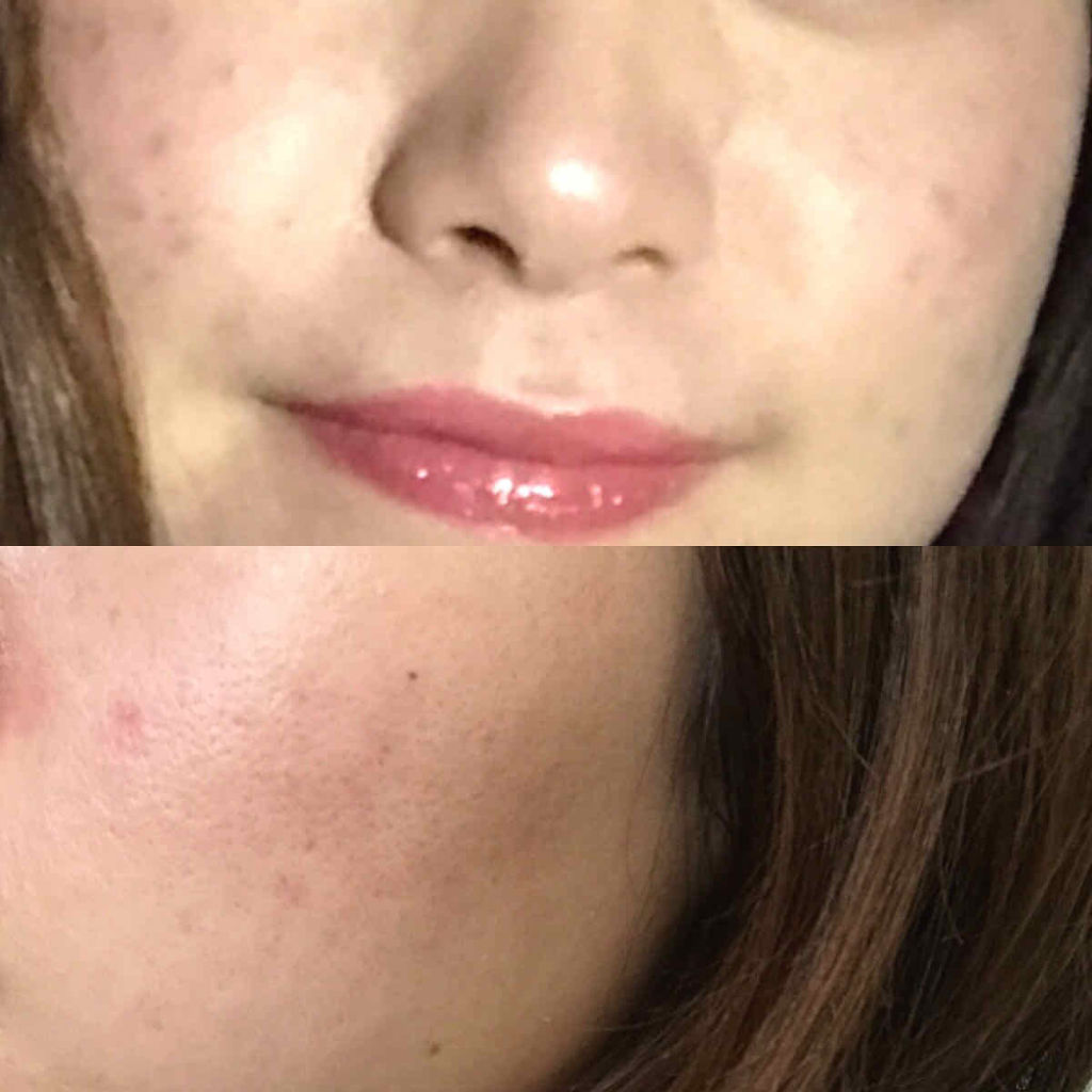 ザ タイムr アクア Ipsaの口コミ 写真2枚目汚肌アップ失礼します By ナミ 代前半 Lips