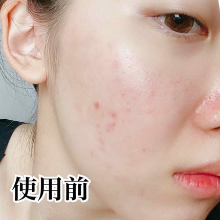 【旧】ディオールスキン フォーエヴァー フルイド グロウ/Dior/リキッドファンデーションを使ったクチコミ(2枚目)