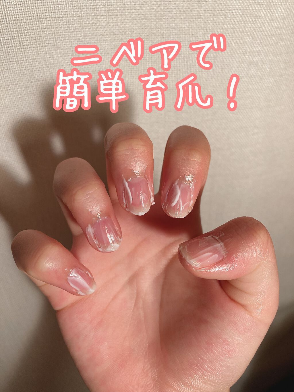 ニベアクリーム/ニベア/ボディクリームを使ったクチコミ(1枚目)