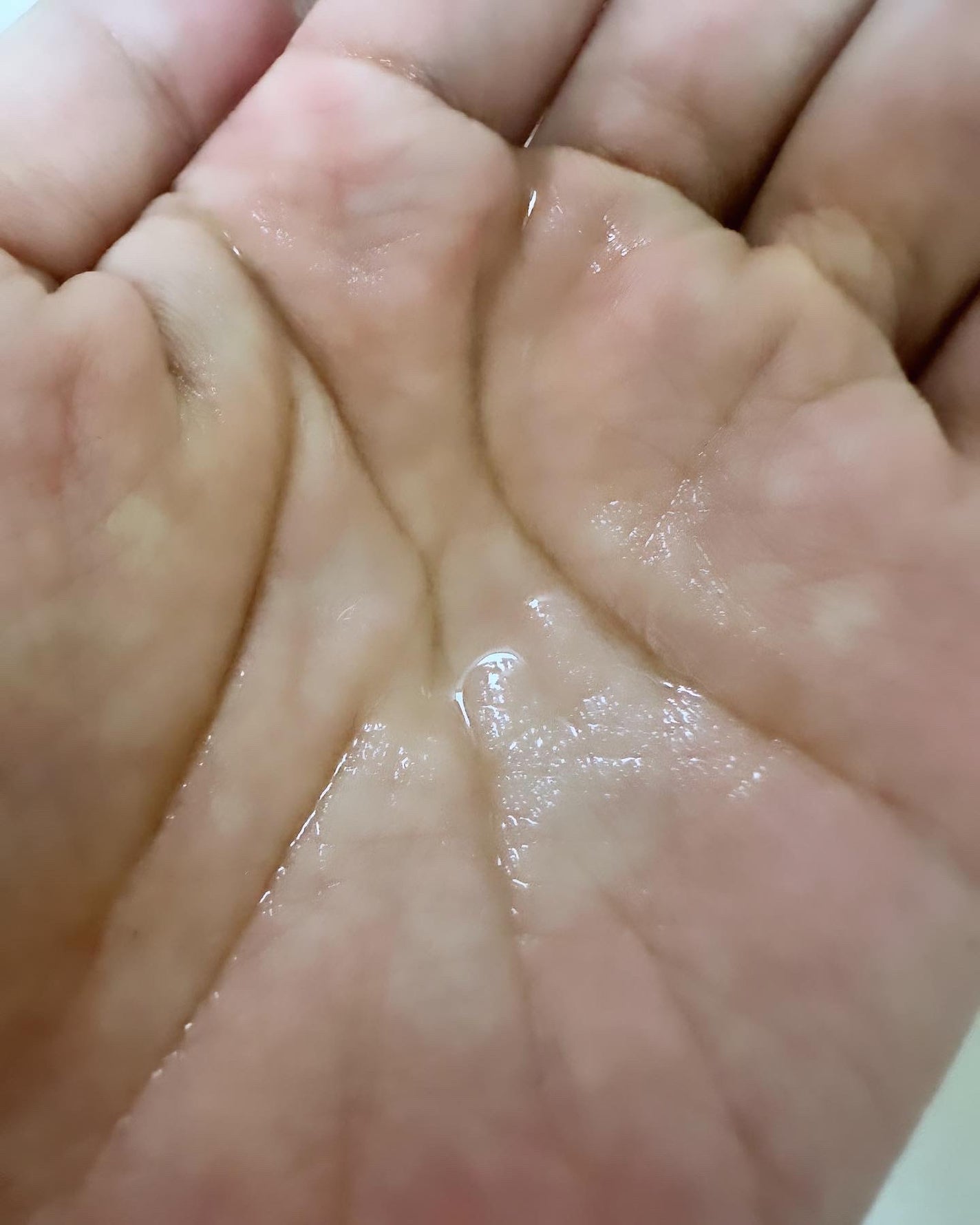 ヘパトリート 薬用保湿化粧水/ゼトックスタイル/化粧水を使ったクチコミ(3枚目)