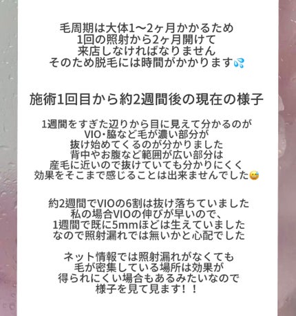 クアトロライト 敏感肌用 (2本入)/シック/シェーバーを使ったクチコミ(2枚目)