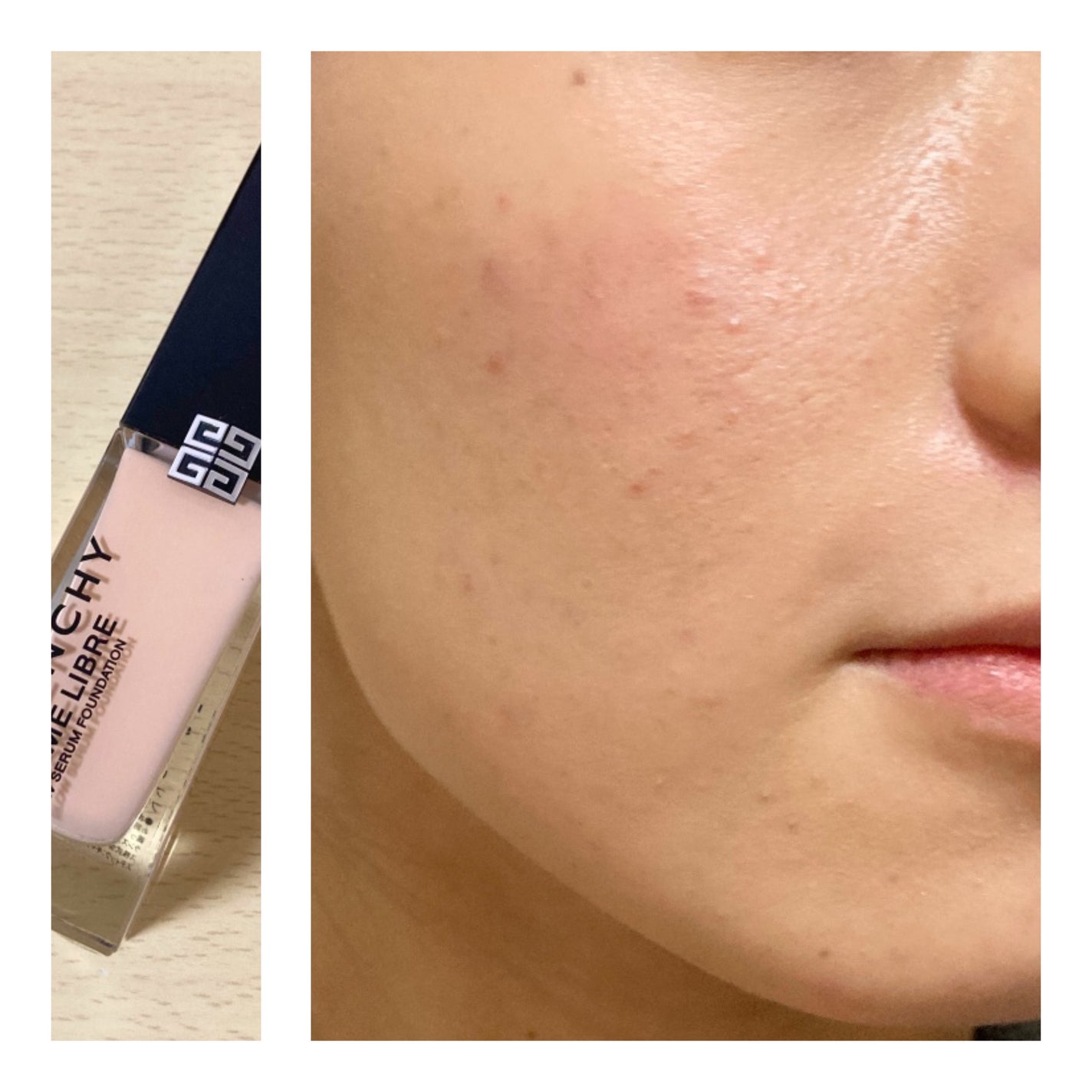 ãšãã»ã³ã¹ ã¹ãã³ã°ã㊠ãã¡ã³ããŒã·ã§ã³/SHISEIDO/ãªããããã¡ã³ããŒã·ã§ã³ã䜿ã£ãã¯ãã³ãïŒ4æç®ïŒ