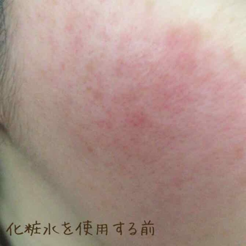 モイスチャーハーバルウォーター ラベンダー／カモミール 本体/MARKS&WEB/ミスト状化粧水を使ったクチコミ（2枚目）