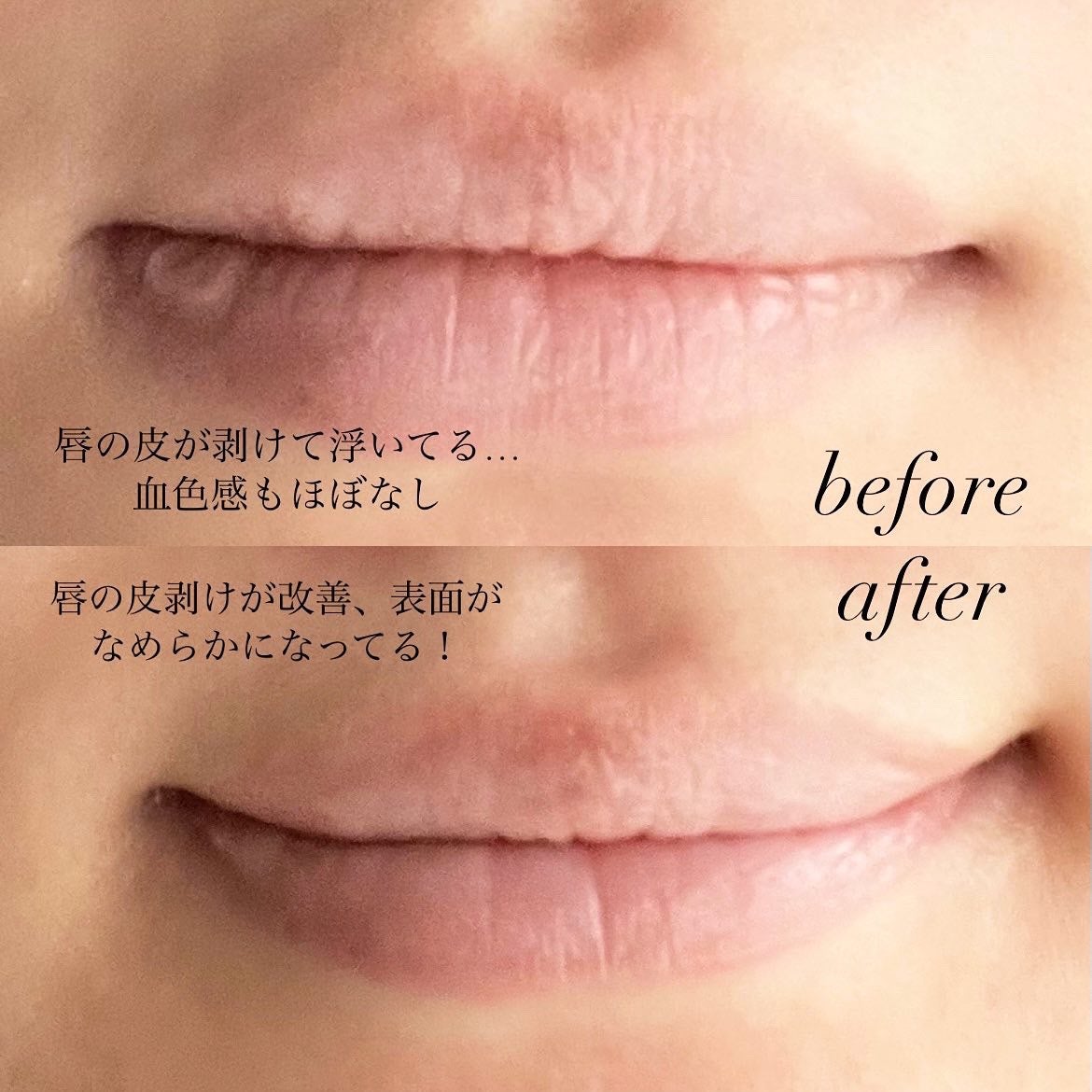 なぁな@フォロバ100 on LIPS 「#PRBeautiTopping様を通してETUDE様よりいた..」(5枚目)