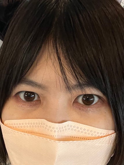 ディオールスキン フォーエヴァー フルイド グロウ/Dior/リキッドファンデーションを使ったクチコミ(1枚目)