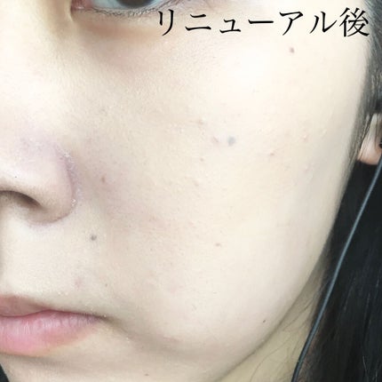 THE FIRST CUSHION COVER/MERZY/クッションファンデーションを使ったクチコミ(4枚目)