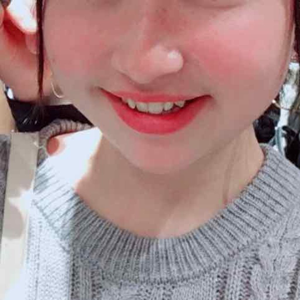 薬用 しみ 集中対策 美容液/メラノCC/美容液を使ったクチコミ(2枚目)