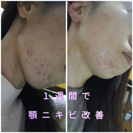 キャスターオイル/マカダミ屋/ボディオイルを使ったクチコミ(1枚目)