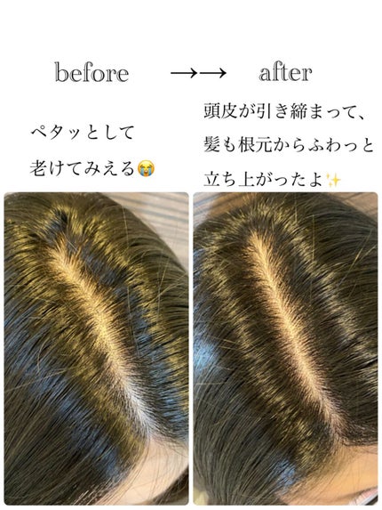 ルメント ヘッドスパ/Le ment/ヘッドマッサージャーを使ったクチコミ(3枚目)
