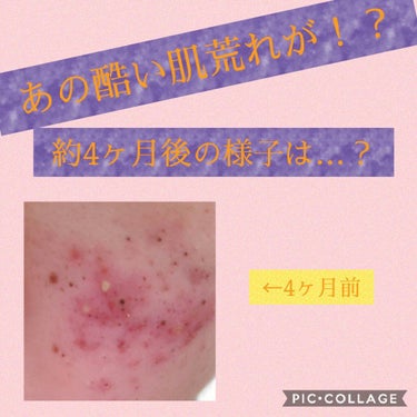 敏感肌用薬用美白化粧水/無印良品/化粧水を使ったクチコミ（1枚目）