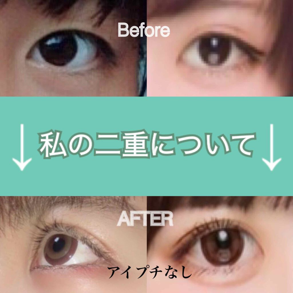 のびーるアイテープ(絆創膏タイプ、レギュラー)/DAISO/二重まぶた用アイテムを使ったクチコミ(1枚目)