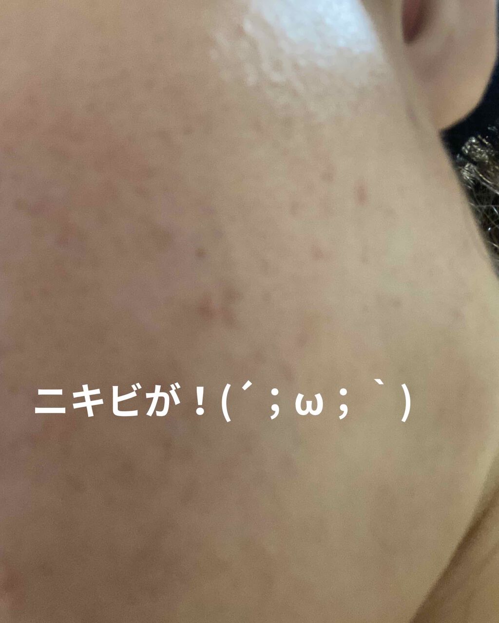 薬用泡のふんわり洗顔/スキンライフ/泡洗顔を使ったクチコミ（2枚目）