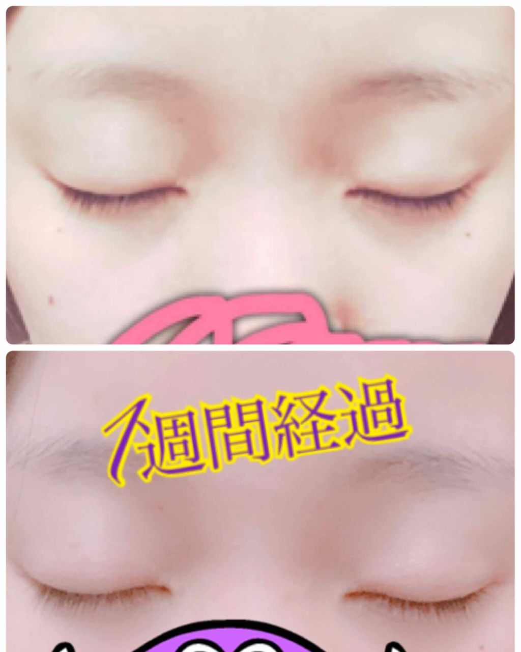 EMAKED(エマーキット)/水橋保寿堂製薬/まつげ美容液を使ったクチコミ(1枚目)