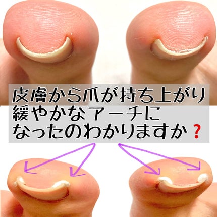 フットスプレー/8x4/レッグ・フットケアを使ったクチコミ(6枚目)