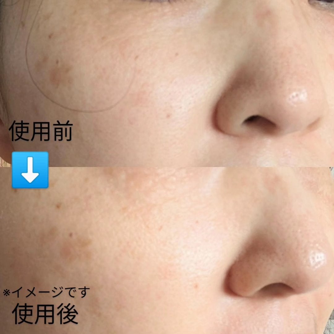 アクティブCp エッセンスシートマスク/OGP/シートマスク・パックを使ったクチコミ(5枚目)