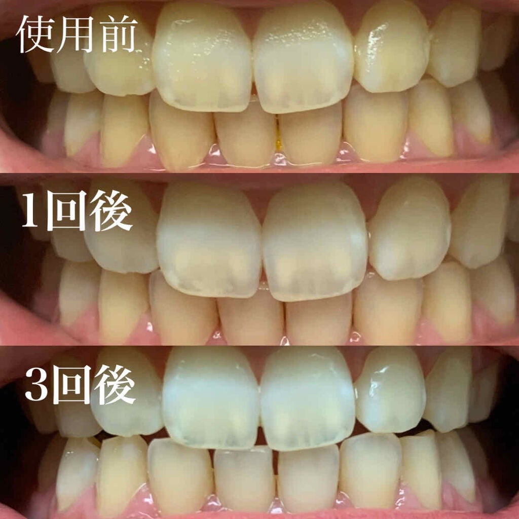 はみがき スペシャル/セッチマ/歯磨き粉を使ったクチコミ(2枚目)
