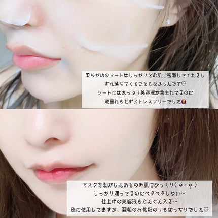 I.P.IライトマックスAPマスクEX/MEDIHEAL/シートマスク・パックを使ったクチコミ(4枚目)