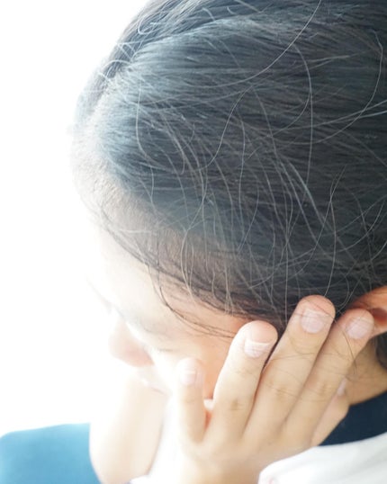 アクネケア ジェル乳液 <医薬部外品>/ファンケル/乳液を使ったクチコミ(5枚目)