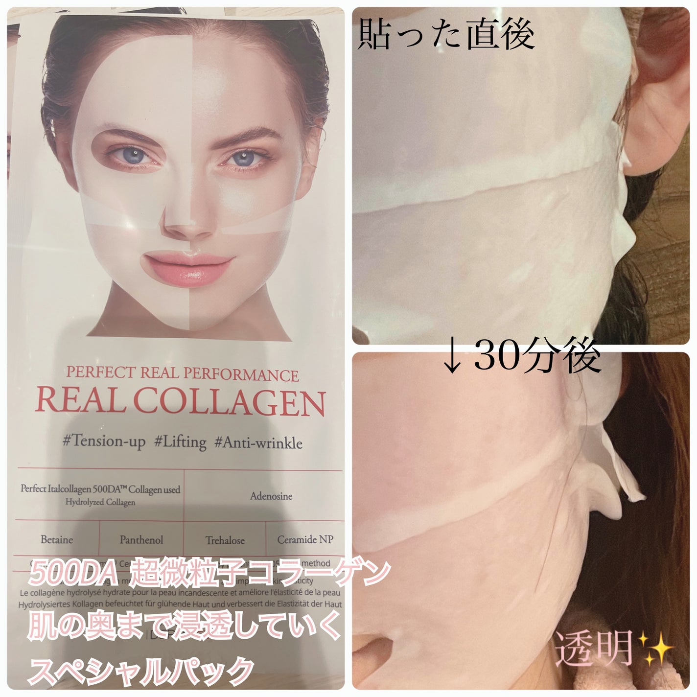 ℳ フォロバ100 on LIPS 「ダーマフィックス様のコラーゲンマスクパック!すばやくハリを取り..」(2枚目)