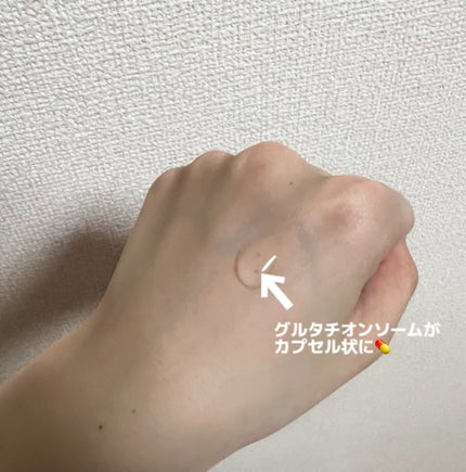 ã¢ãããã°ã«ã¿ããªã³ãœãŒã ããŒã¯ã¹ãããã»ã©ã ãã¿ãããã/Abib /çŸå®¹æ¶²ã䜿ã£ãã¯ãã³ãïŒ3æç®ïŒ