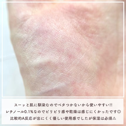 シカレチA エッセンス0.1/VT/美容液を使ったクチコミ(4枚目)