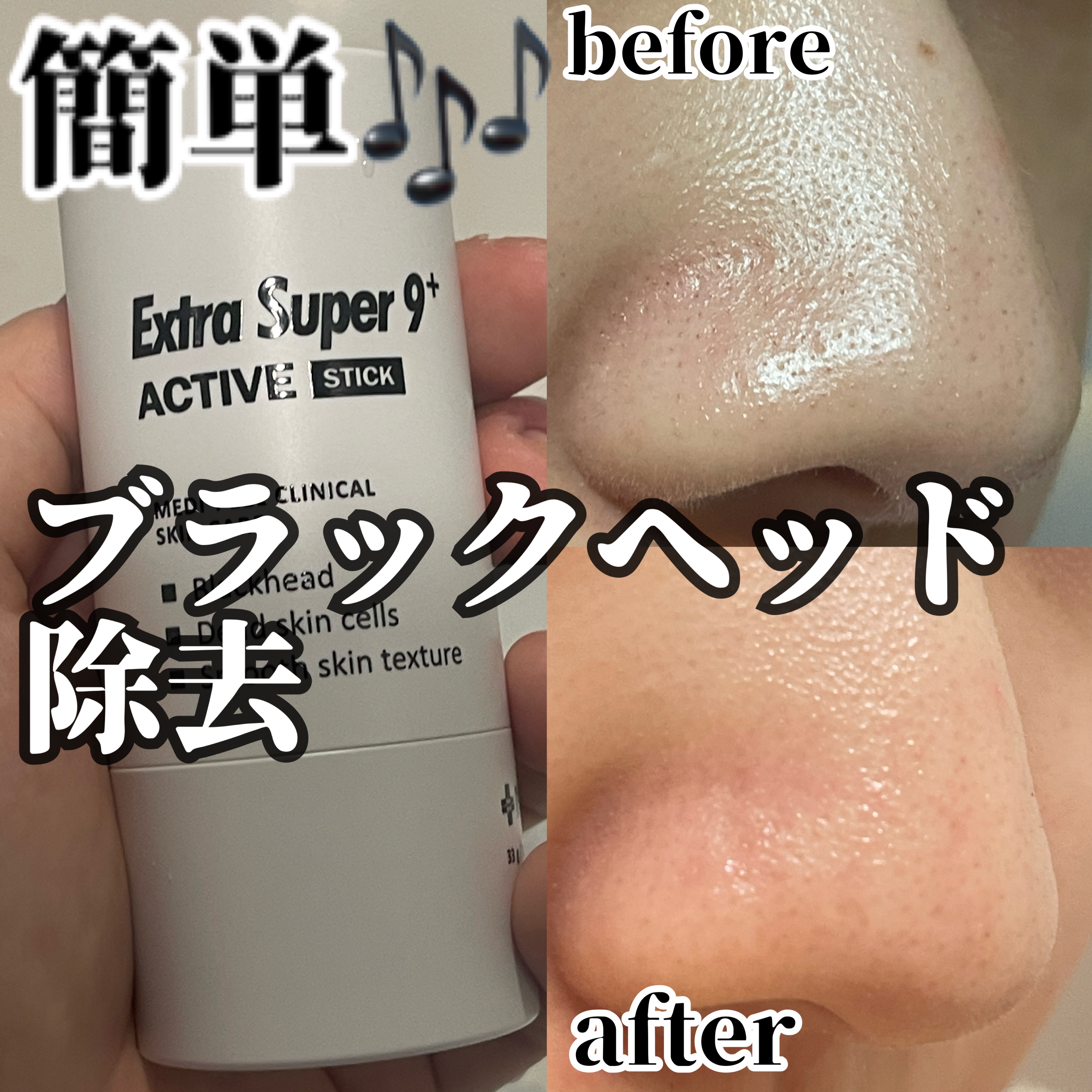 エクストラ スーパー9プラス アクティブ スティック/MEDIPEEL/ピーリングを使ったクチコミ（1枚目）