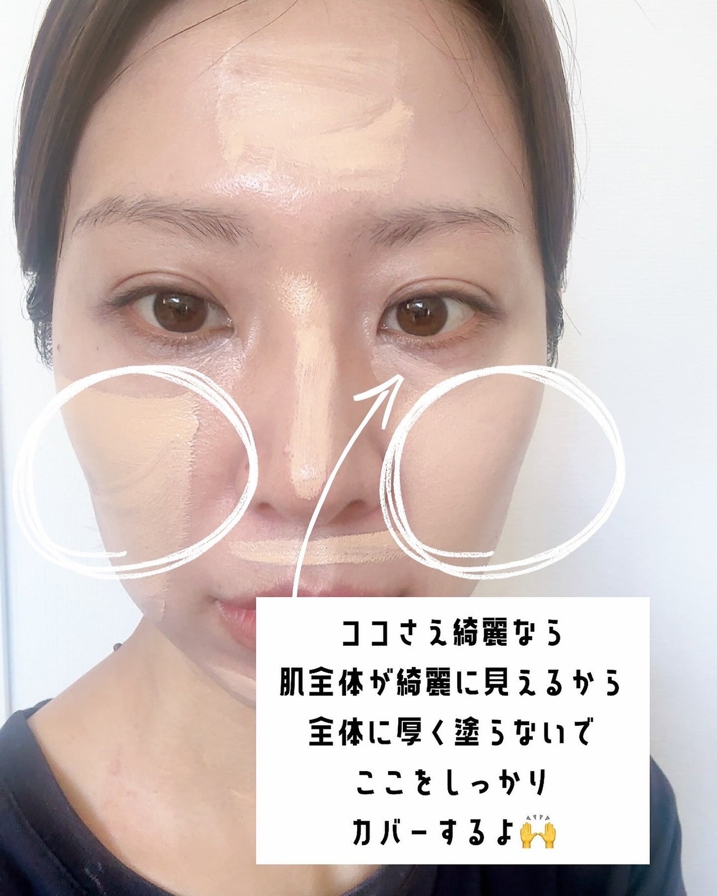 メイクヒール1.P.L ファンデーザー/SPF20 PA++/MAKEHEAL/リキッドコンシーラーを使ったクチコミ(3枚目)