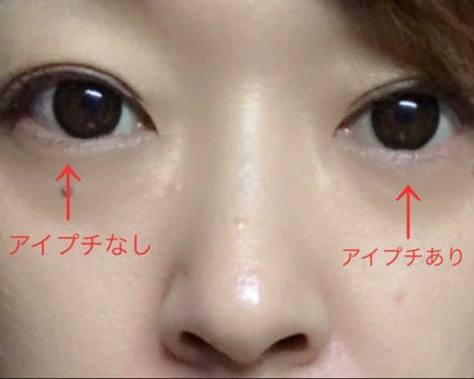 【旧品】オリシキ アイリッドスキンフィルム/D-UP/二重まぶた用アイテムを使ったクチコミ(4枚目)