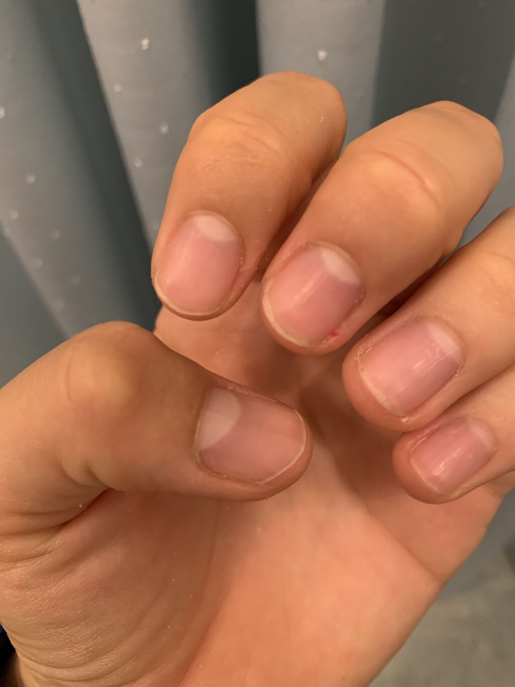 ウィンマックス キューティクルオイル/DAISO/ネイルオイル・トリートメントを使ったクチコミ（2枚目）