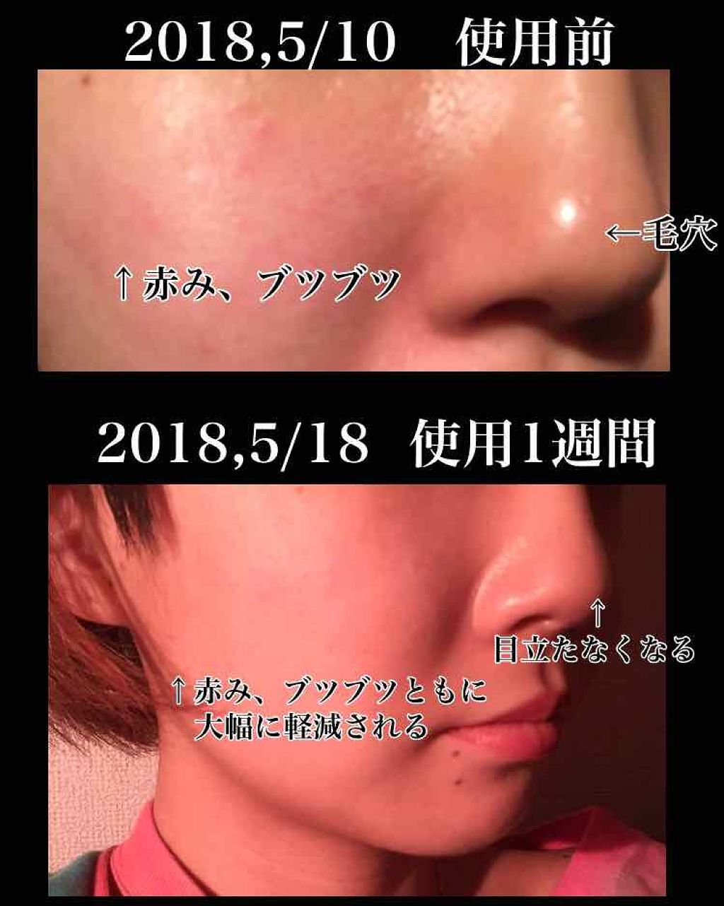 ウォッシャブル コールド クリーム/ちふれ/クレンジングクリームを使ったクチコミ（2枚目）