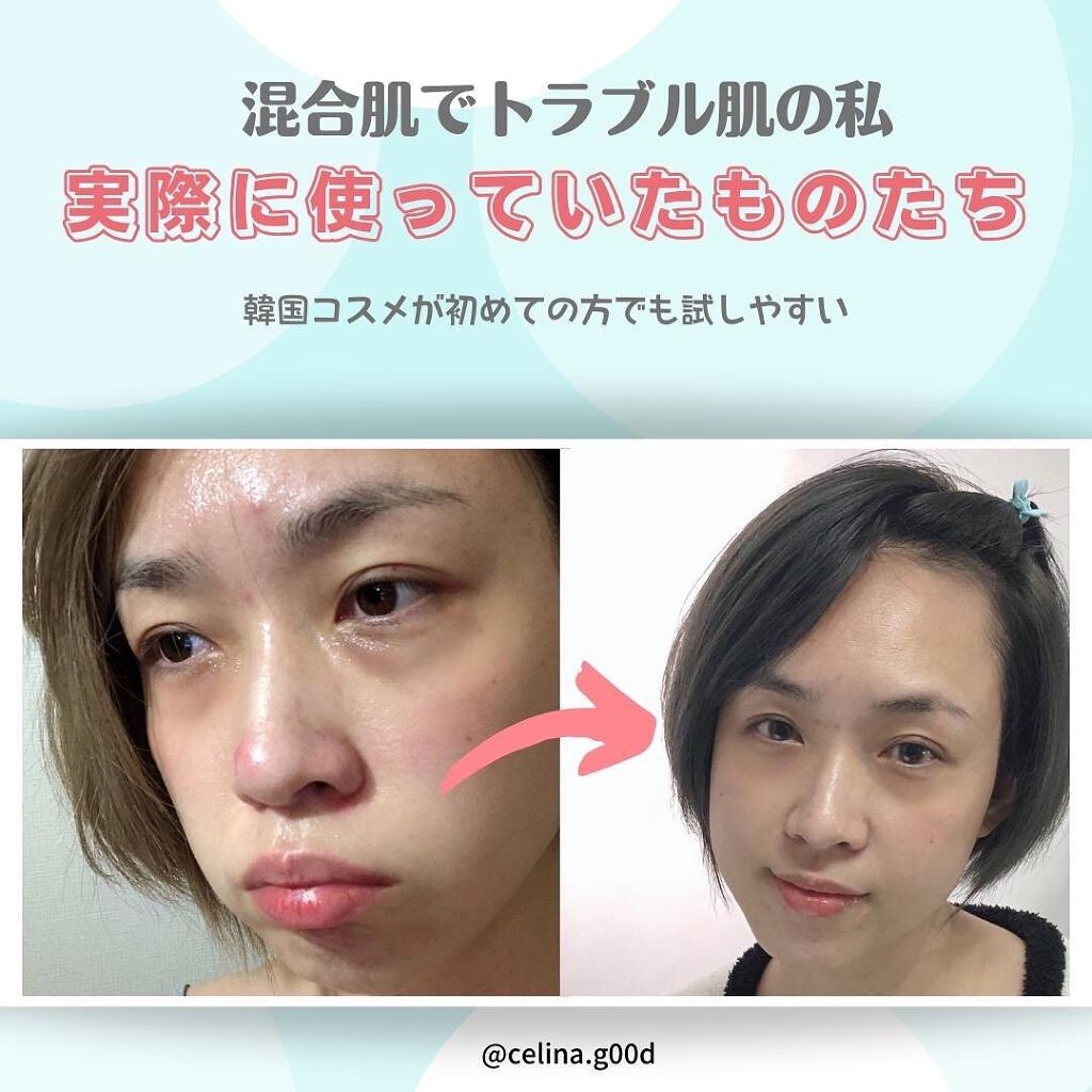 シカフルアンプル/beplain/美容液を使ったクチコミ（2枚目）