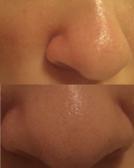 パワーマスク SP/ラッシュ/スクラブ・ゴマージュを使ったクチコミ(4枚目)