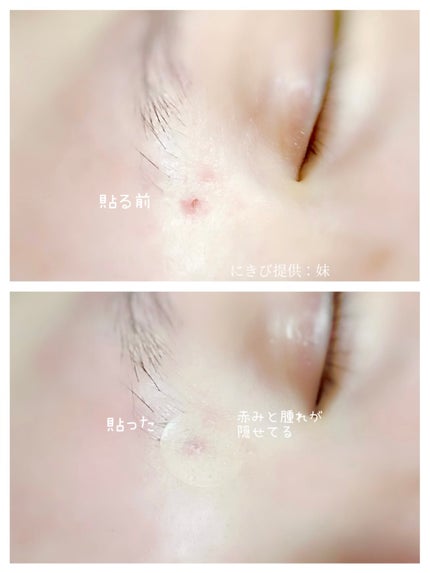 ã»ããŠðãã©ãã(æçš¿ããæ¹) on LIPS ããQoo10ã¡ã¬å²ãããããæŠå
補è¬ã®ã¹ããããšã€ãâââââ..ãïŒ4æç®ïŒ