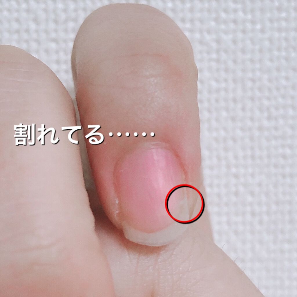 AT トップ＆ベースコート/Art Collection/ネイルトップコートを使ったクチコミ（2枚目）