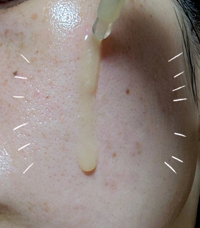 バランス リペアセラム/SKINFONIA/美容液を使ったクチコミ（2枚目）