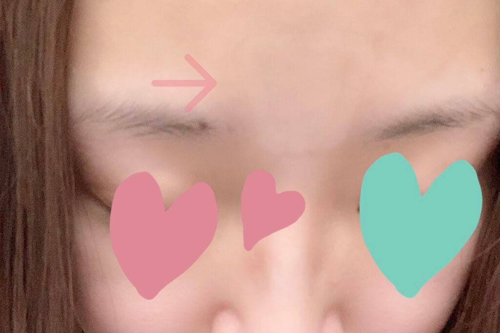 ミケンディープパッチ/北の快適工房/シートマスク・パックを使ったクチコミ(6枚目)