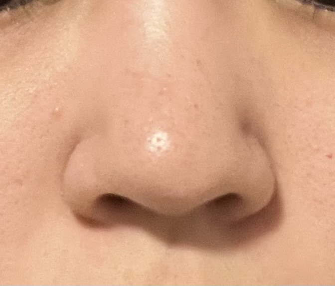 センテラ ライトクレンジングオイル/SKIN1004/オイルクレンジングを使ったクチコミ（1枚目）